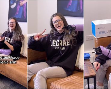 Adolescente Amputada Recebe Braço Biónico e Não Consegue Esconder a Sua Alegria Adolescente Amputada Recebe Braço Biónico e Não Consegue Esconder a Sua Alegria