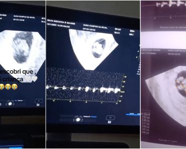 Grávida Passa Mal Durante Ultrassom Ao Descobrir Que Espera… Cinco Bebés Grávida Passa Mal Durante Ultrassom Ao Descobrir Que Espera… Cinco Bebés