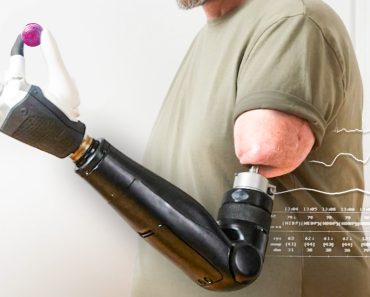 Este Braço Biónico é Controlado Pelo Cérebro Do Utilizador Este Braço Biónico é Controlado Pelo Cérebro Do Utilizador