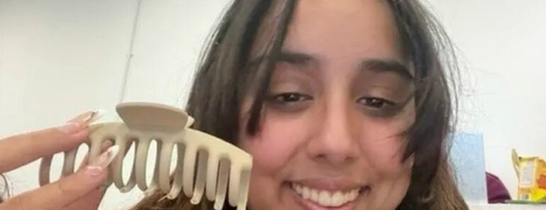 Como Uma Mola De Cabelo Quase Matou Jovem Num Acidente De Carro Como Uma Mola De Cabelo Quase Matou Jovem Num Acidente De Carro