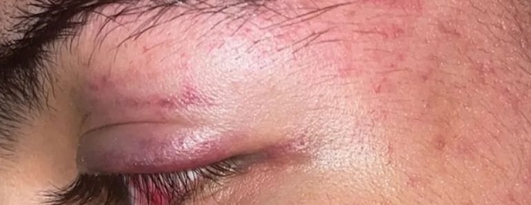 Alenquer e Benfica Denuncia “Criminosa Emboscada” Feita Pelo Negrais e Mostra Imagens Das Agressões Alenquer e Benfica Denuncia “Criminosa Emboscada” Feita Pelo Negrais e Mostra Imagens Das Agressões